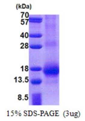 SDS-PAGE: Recombinant Human RNF7 His Protein [NBP2-23442]