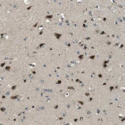 Immunohistochemistry-Paraffin: RNF70 Antibody [NBP1-87399]