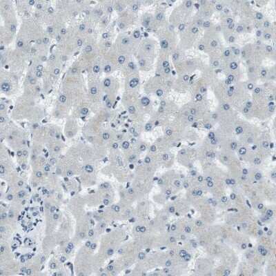 Immunohistochemistry-Paraffin: RNF70 Antibody [NBP1-87399]