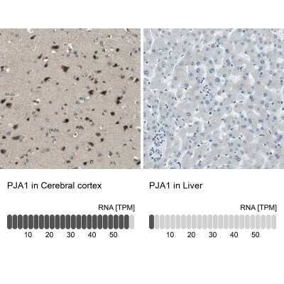 Immunohistochemistry-Paraffin: RNF70 Antibody [NBP1-87399]