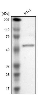 Western Blot: RNF70 Antibody [NBP1-87399]