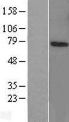 Western Blot: RNF70 Overexpression Lysate [NBL1-14453]