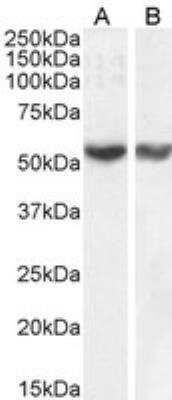 Western Blot: RNF8 Antibody [NB100-1176]