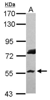 Western Blot: RNF8 Antibody [NBP2-20193]