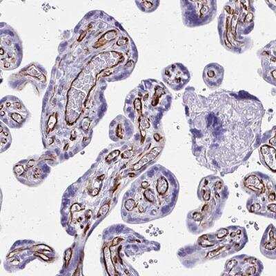 Immunohistochemistry-Paraffin: RNF89 Antibody [NBP2-31826]