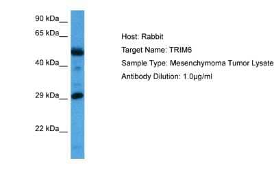 Western Blot: RNF89 Antibody [NBP2-83461]