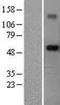 Western Blot: RNF89 Overexpression Lysate [NBL1-17309]