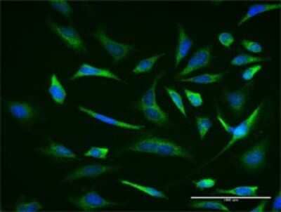 Immunocytochemistry/ Immunofluorescence: RNF98 Antibody (1G11) [H00055521-M02]