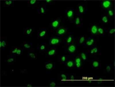 Immunocytochemistry/ Immunofluorescence: RNF98 Antibody (2D11) [H00055521-M01]
