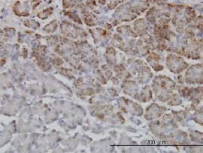 Immunohistochemistry-Paraffin: RNF98 Antibody (2D11) [H00055521-M01]