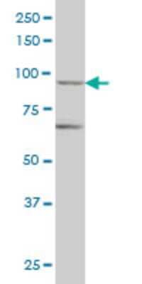 Western Blot: RNF98 Antibody (2D11) [H00055521-M01]