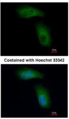 Immunocytochemistry/ Immunofluorescence: RNF98 Antibody [NBP1-33644]