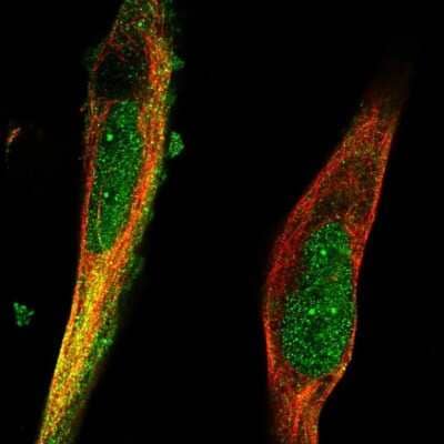 Immunocytochemistry/ Immunofluorescence: RNF98 Antibody [NBP2-56200]