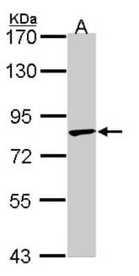 Western Blot: RNF98 Antibody [NBP1-33644]