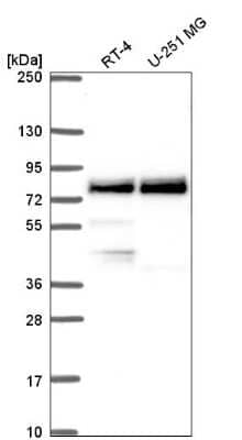 Western Blot: RNF98 Antibody [NBP2-56200]