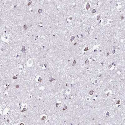 Immunohistochemistry-Paraffin: RNFT2 Antibody [NBP2-32383]