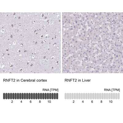 Immunohistochemistry-Paraffin: RNFT2 Antibody [NBP2-32383]