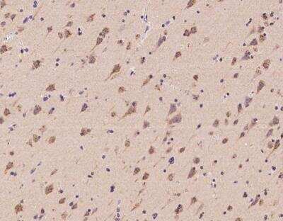 Immunohistochemistry-Paraffin: RNFT2 Antibody [NBP3-06145]