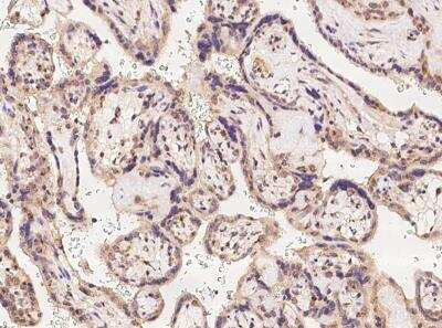 Immunohistochemistry-Paraffin: RNFT2 Antibody [NBP3-06145]