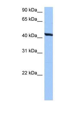 Western Blot: RNFT2 Antibody [NBP1-60000]