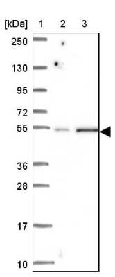 Western Blot: RNFT2 Antibody [NBP2-32383]