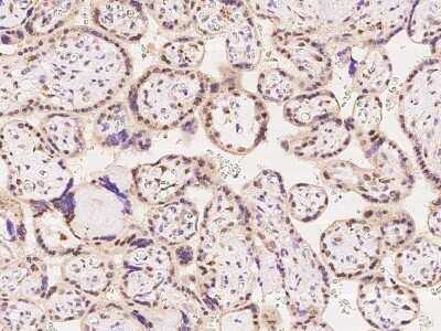 Immunohistochemistry-Paraffin: RNGTT Antibody [NBP2-97837]