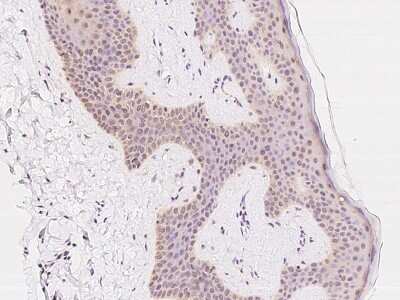 Immunohistochemistry-Paraffin: RNGTT Antibody [NBP2-97837]