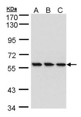 Western Blot: RNGTT Antibody [NBP1-32711]