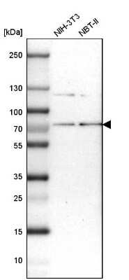 Western Blot: RNGTT Antibody [NBP1-83281]