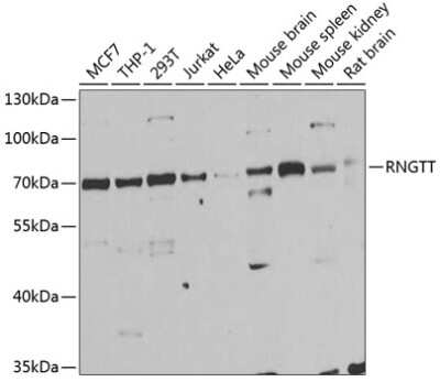 Western Blot: RNGTT AntibodyBSA Free [NBP2-94014]