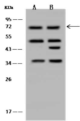 Western Blot: RNGTT Antibody [NBP2-97837]