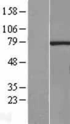 Western Blot: RNGTT Overexpression Lysate [NBL1-15461]