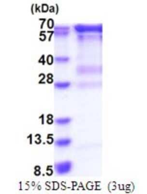 SDS-PAGE: Recombinant Human RNGTT His Protein [NBP2-51817]