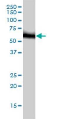 Western Blot: RNMT Antibody (3H3-1D12) [H00008731-M01]