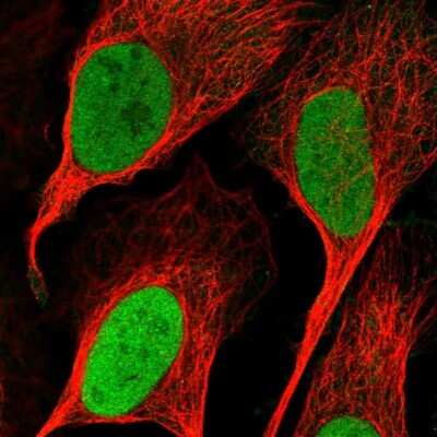 Immunocytochemistry/ Immunofluorescence: RNMT Antibody [NBP1-80841]