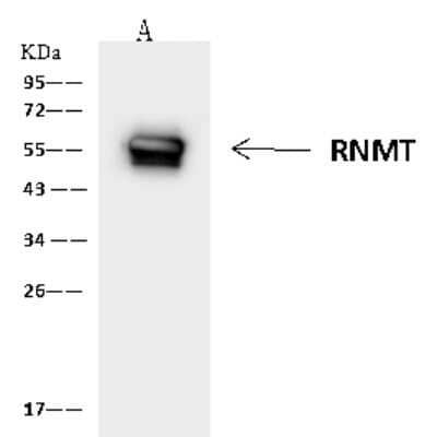 Immunoprecipitation: RNMT Antibody [NBP2-97644]