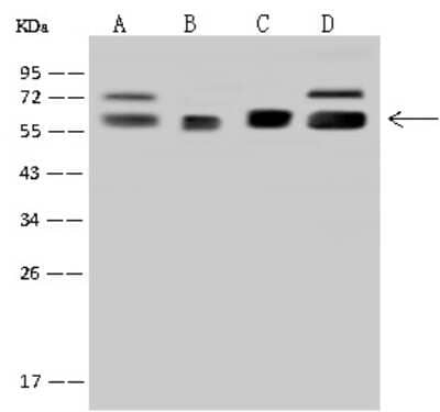 Western Blot: RNMT Antibody [NBP2-97644]