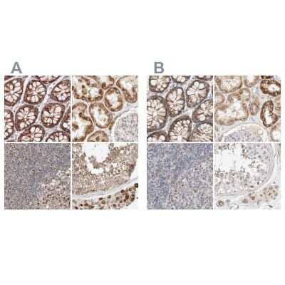 Immunohistochemistry-Paraffin: RNMTL1 Antibody [NBP1-83843]