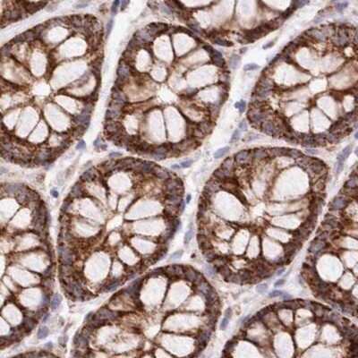 Immunohistochemistry-Paraffin: RNMTL1 Antibody [NBP1-83843]