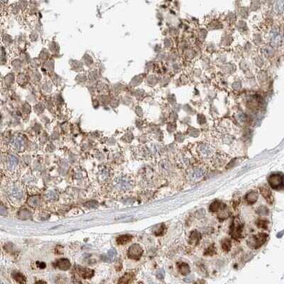 Immunohistochemistry-Paraffin: RNMTL1 Antibody [NBP1-83843]