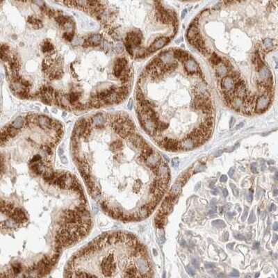 Immunohistochemistry-Paraffin: RNMTL1 Antibody [NBP1-83843]