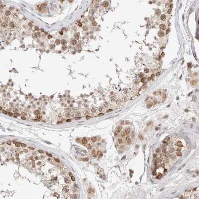 Immunohistochemistry-Paraffin: RNMTL1 Antibody [NBP1-83844]