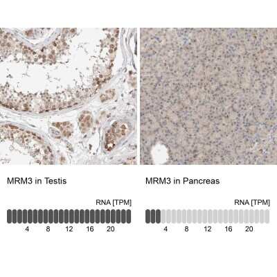 Immunohistochemistry-Paraffin: RNMTL1 Antibody [NBP1-83844]