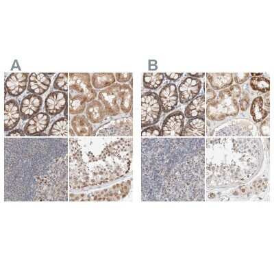 Immunohistochemistry-Paraffin: RNMTL1 Antibody [NBP1-83844]
