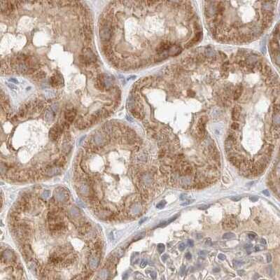 Immunohistochemistry-Paraffin: RNMTL1 Antibody [NBP1-83844]
