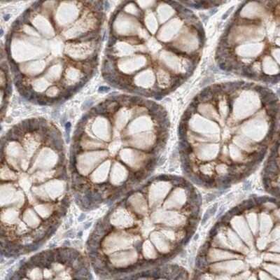 Immunohistochemistry-Paraffin: RNMTL1 Antibody [NBP1-83844]