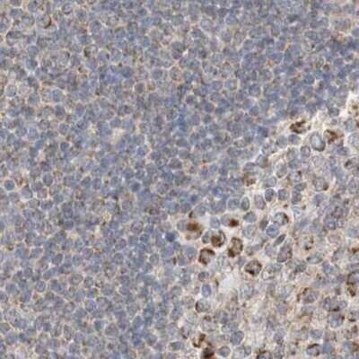 Immunohistochemistry-Paraffin: RNMTL1 Antibody [NBP1-83844]
