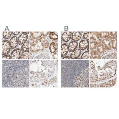 Immunohistochemistry-Paraffin: RNMTL1 Antibody [NBP1-83845]
