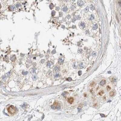 Immunohistochemistry-Paraffin: RNMTL1 Antibody [NBP1-83845]