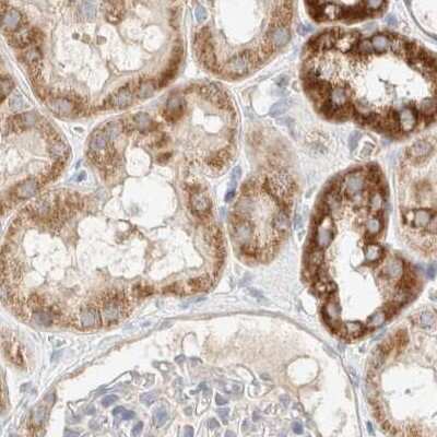 Immunohistochemistry-Paraffin: RNMTL1 Antibody [NBP1-83845]